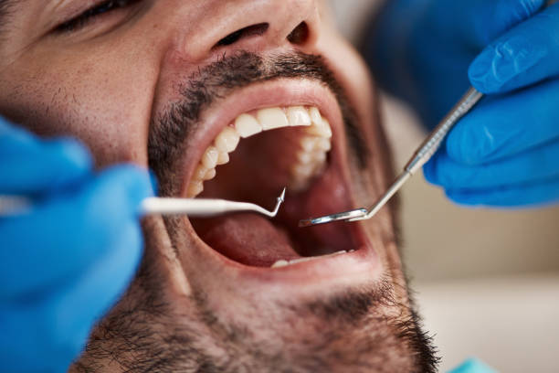 Best Broken Tooth Emergency  in Goshen, AR